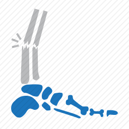 <em>骨骼</em>断裂