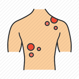 <em>过敏</em>