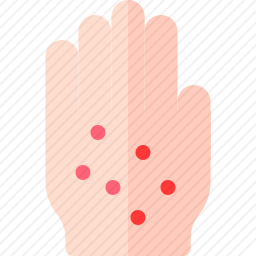 过敏