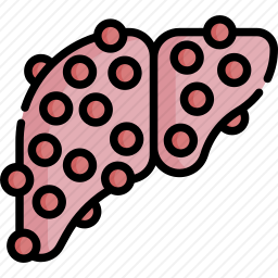 肝硬化