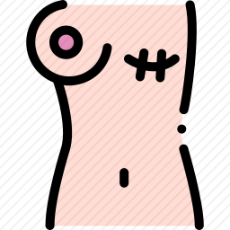 乳腺癌