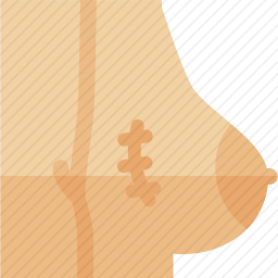 疤痕