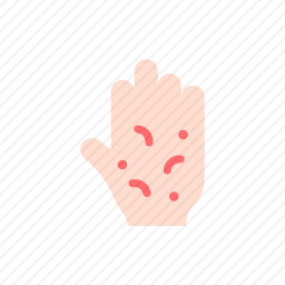 过敏