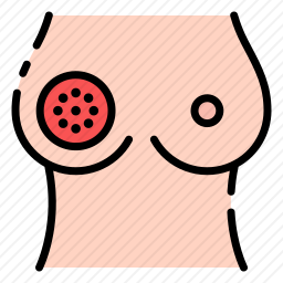 乳腺癌