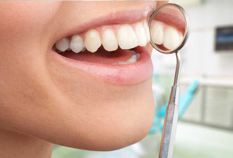 洁白的牙齿接受牙医的工具检查