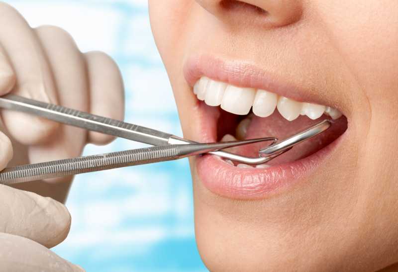 洁白的牙齿接受牙医的牙齿检查