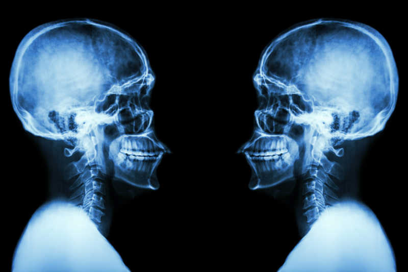头颅和颈椎x线片