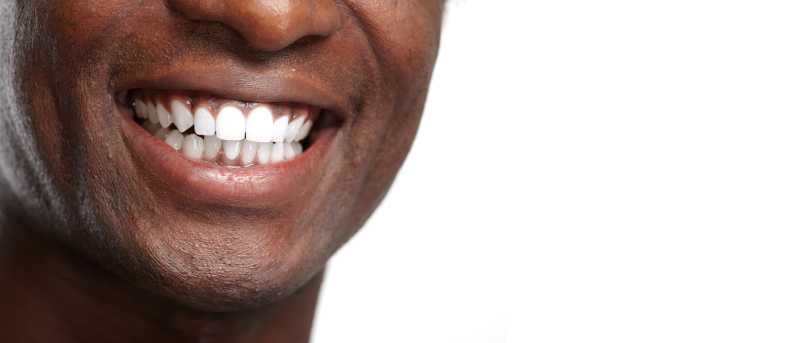 白色背景下一个非洲男子露着一口洁白健康的牙齿