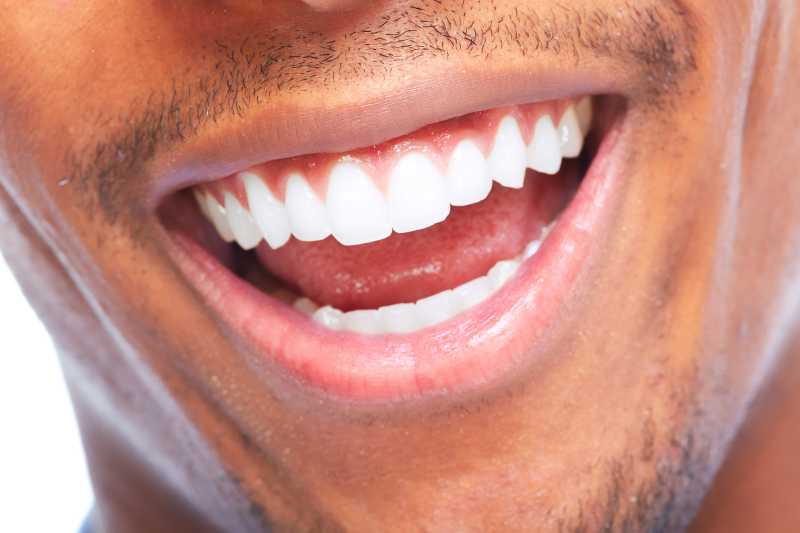 黑人男子的洁白健康牙齿