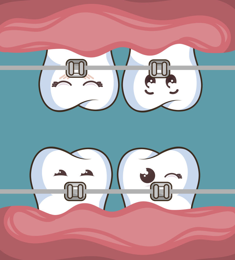 矢量戴牙套的卡通牙齿