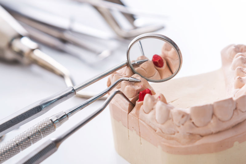 石膏模型与牙科工具