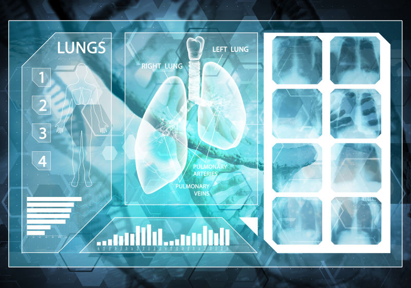 医学背景3D渲染肺部