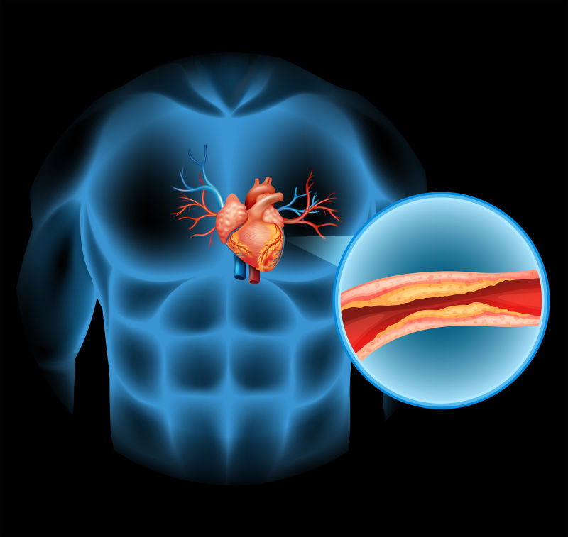 抽象人体心脏胆甾醇图示插图