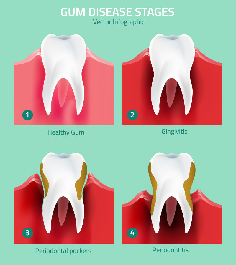 抽象牙齿疾病的矢量插图