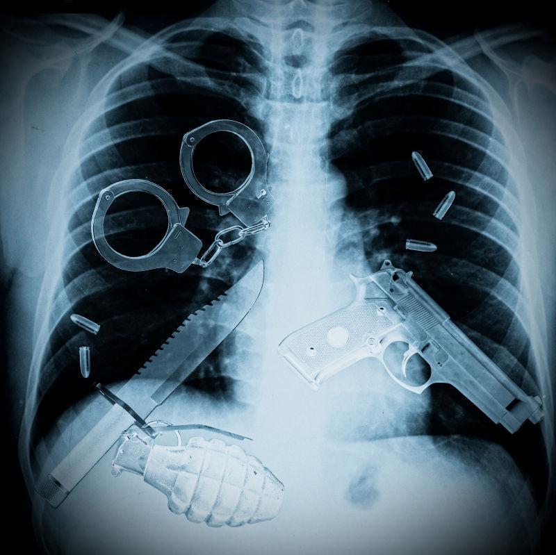 x射线下的胸腔图像