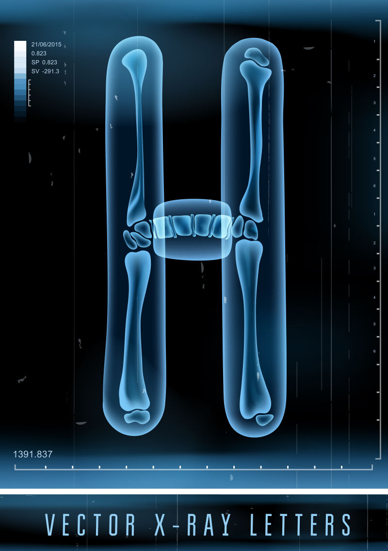 矢量3DX射线透明字母H