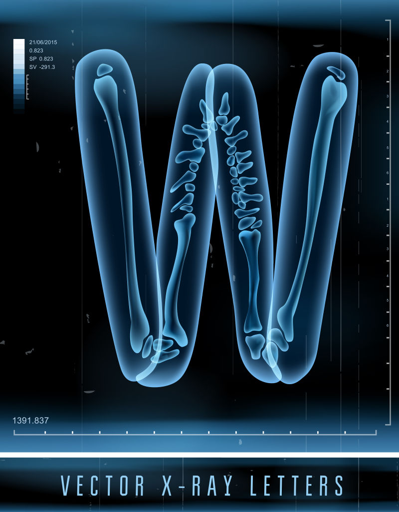 矢量3DX射线透明字母W