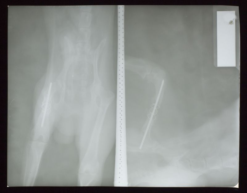 腿骨X光透析图