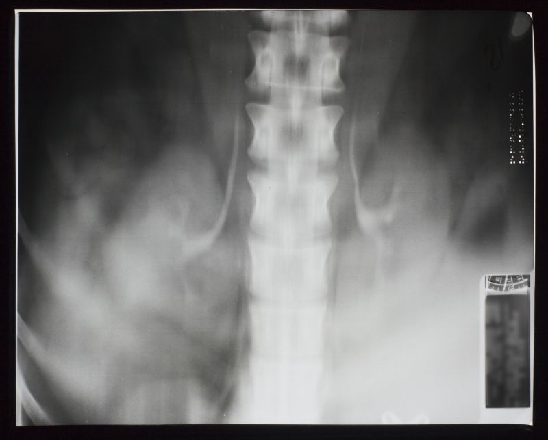 脊椎骨骼x射线片子