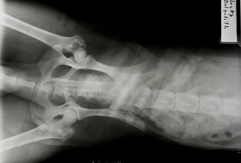 腹部骨盆x射线片子