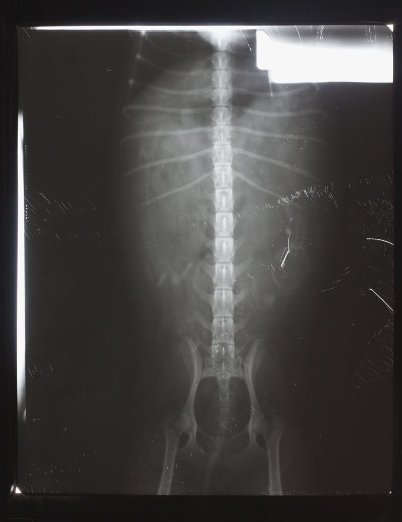 身体脊椎关节x射线片子