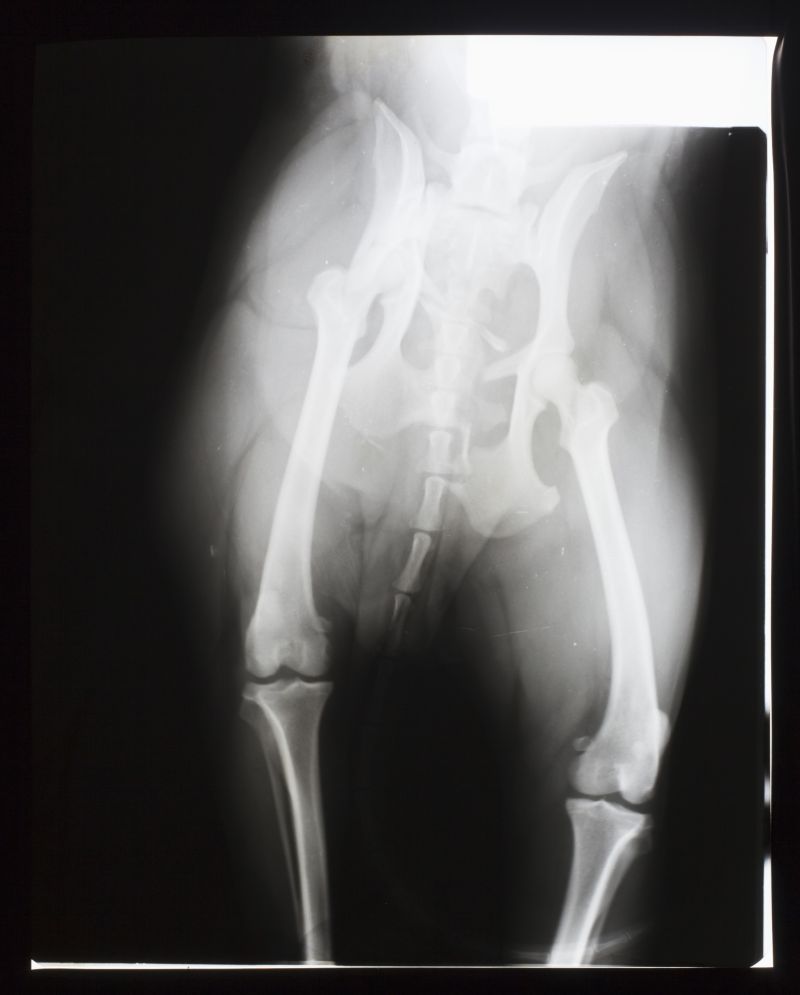 大腿部骨骼x射线片子
