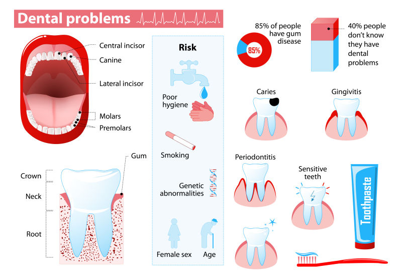 创意矢量卡通牙齿健康问题的插图