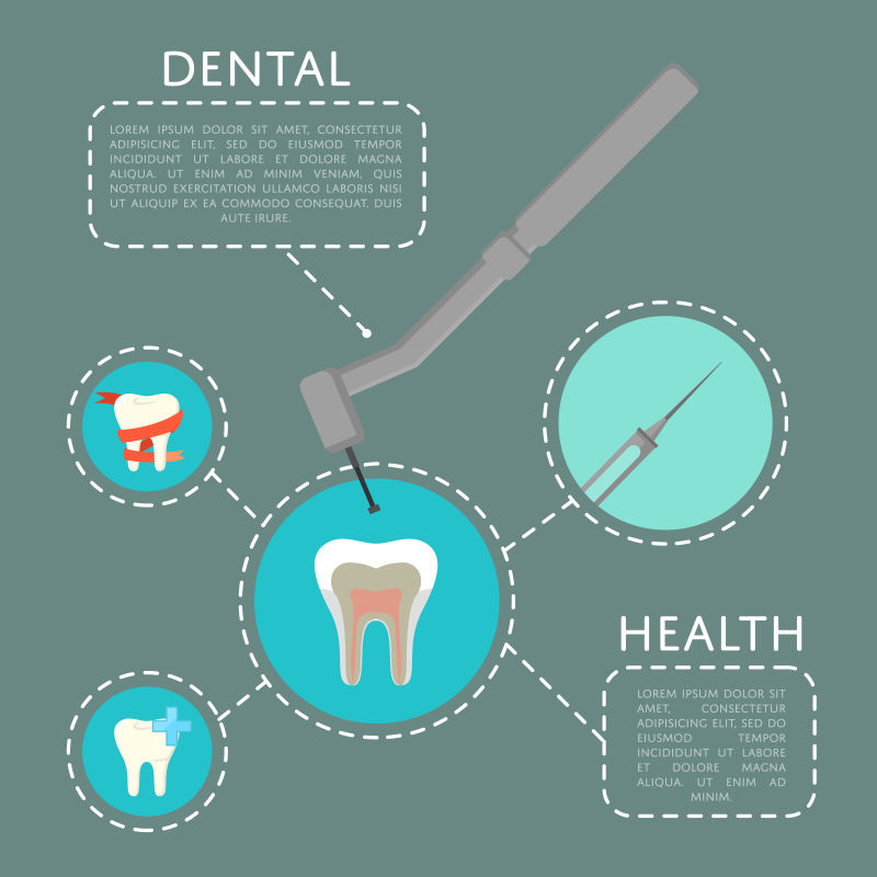 矢量牙齿治疗的图示插图