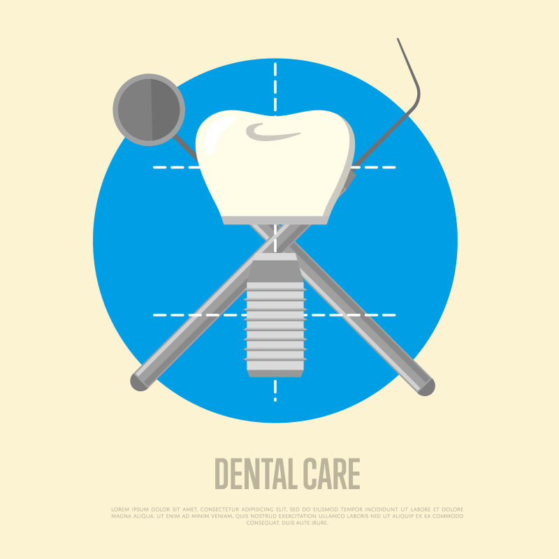 创意矢量种植牙插图