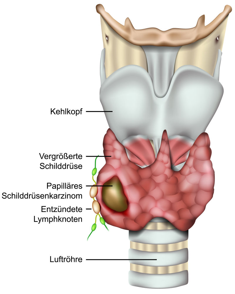 创意矢量人体喉骨的平面插图