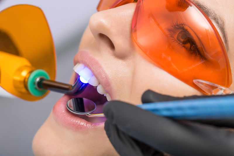 牙科治疗宏观照片