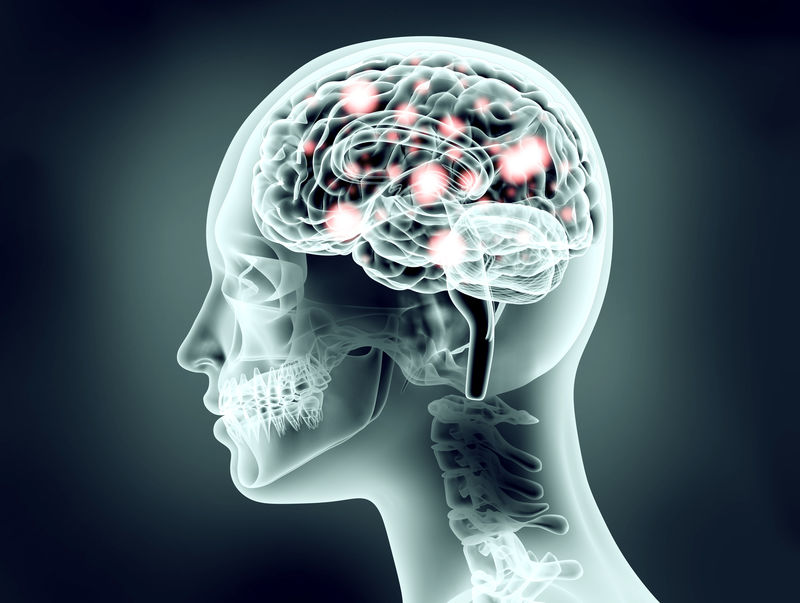 人脑和电脉冲的X射线图像