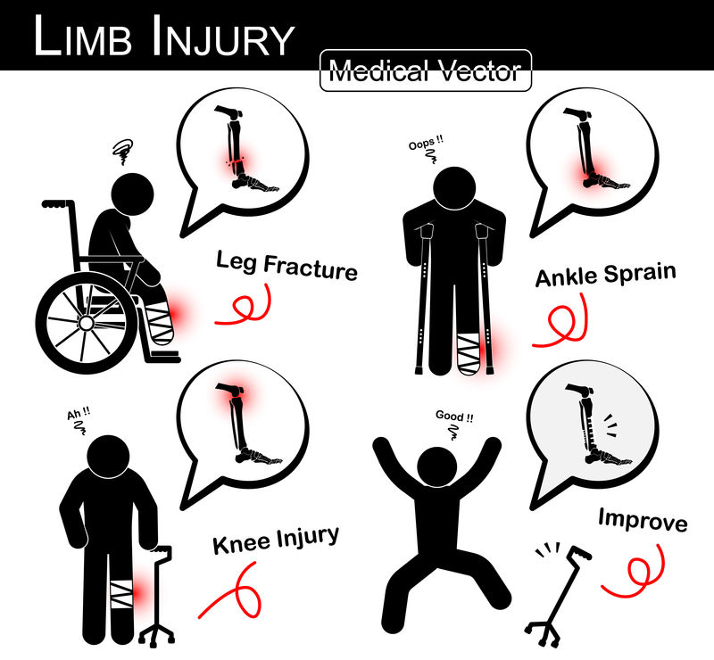 肢体损伤组（带轮椅的棍子人、腋下拐杖、三脚架拐杖）（胫腓骨骨折、踝关节扭伤、膝关节痛）（向量医学棍子人，物理治疗概念）