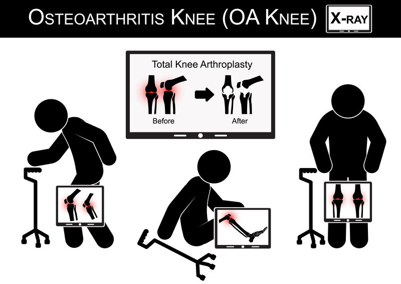 老人膝盖疼痛，监视器显示全膝关节置换术（手术前后）骨关节炎膝关节载体（平面设计）（保健理念）
