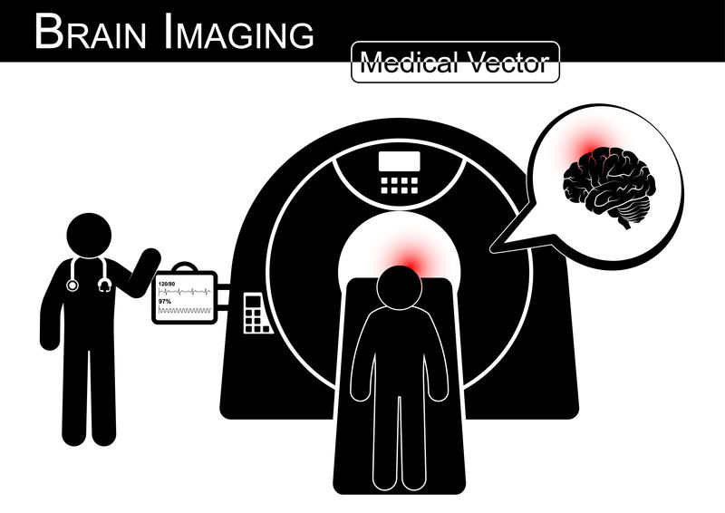 脑成像。患者躺在CT扫描仪上诊断脑部疾病（出血性或缺血性中风、脑肿瘤、脑脓肿等）（黑白/平面设计）（保健概念）