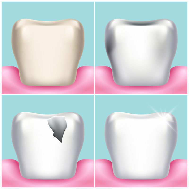 牙齿问题、龋齿、牙菌斑和牙龈疾病、健康牙齿载体说明