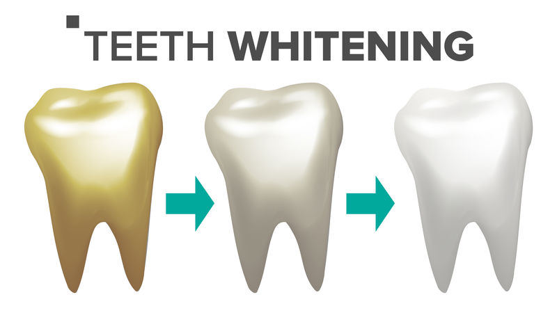 牙齿美白载体。牙齿和牙齿牙齿概念。医疗保健。逼真的独立插图