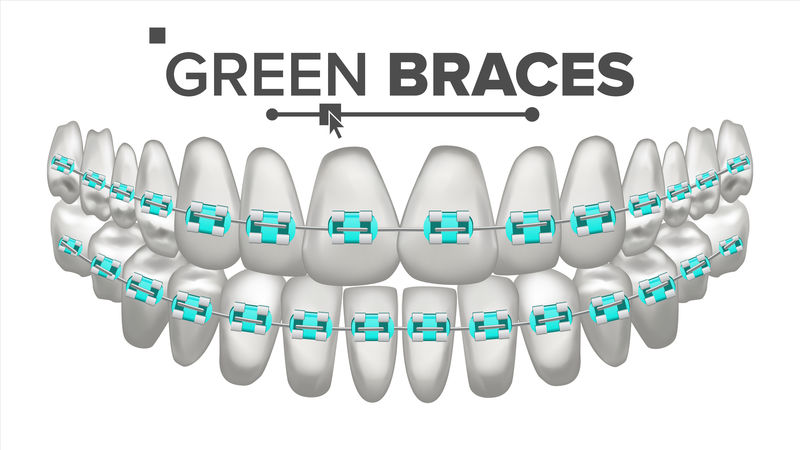 绿色子括号向量。牙齿和牙套。人类的下巴。三维真实独立插图