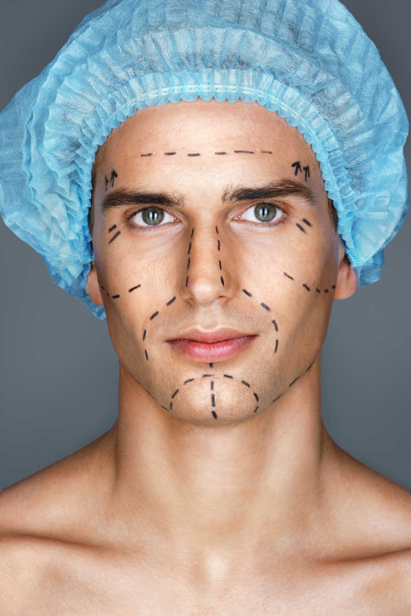 一位脸上画着手术标记线的男人