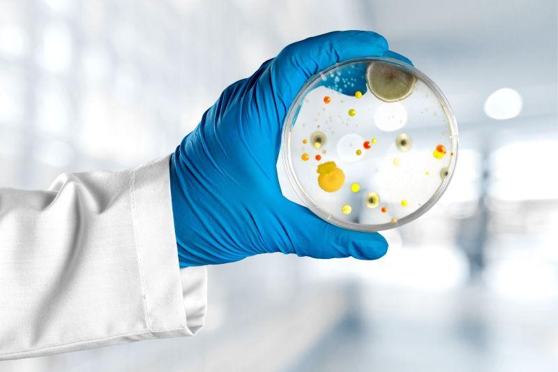 研究专家手中的培养皿中的霉菌
